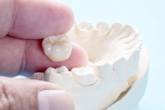 When Are Dental Crowns Necessary? Dental Crowns Necessary