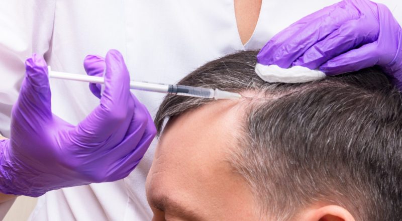 Understanding How PRP Treatments Stimulate Hair Growth PRP Treatments