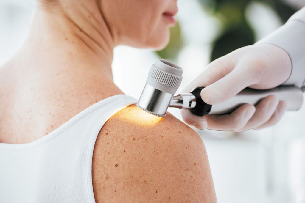 The Role of Dermatologists in Skin Cancer Detection and Treatment Skin Cancer Detection
